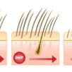 DHT (Diidrotestosterone): qual è il suo ruolo nella perdita di capelli dell’uomo?