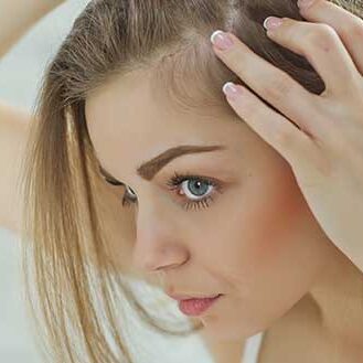 Alopecia da stress o psicogena